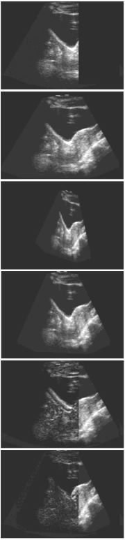 Bigger, Better Ultrasound Volumes | Computer Graphics World